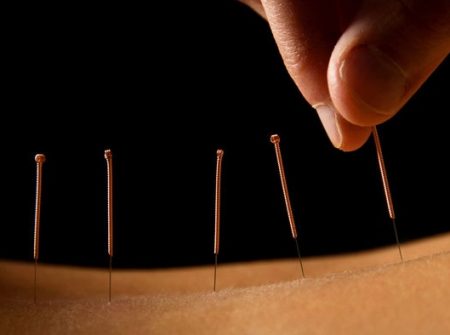 Downtown Acupuncture & Massage